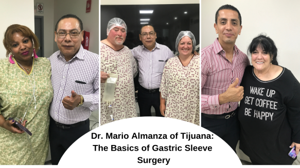 dr. mario almanza of tijuana_ the basics of gastric sleeve surgery